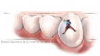 Pinnacle Dental — dental practice in Holladay, UT